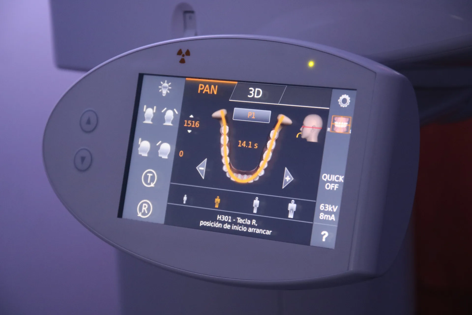 CBCT 3D para planificación de extracción de cordales en PerioMax Alicante