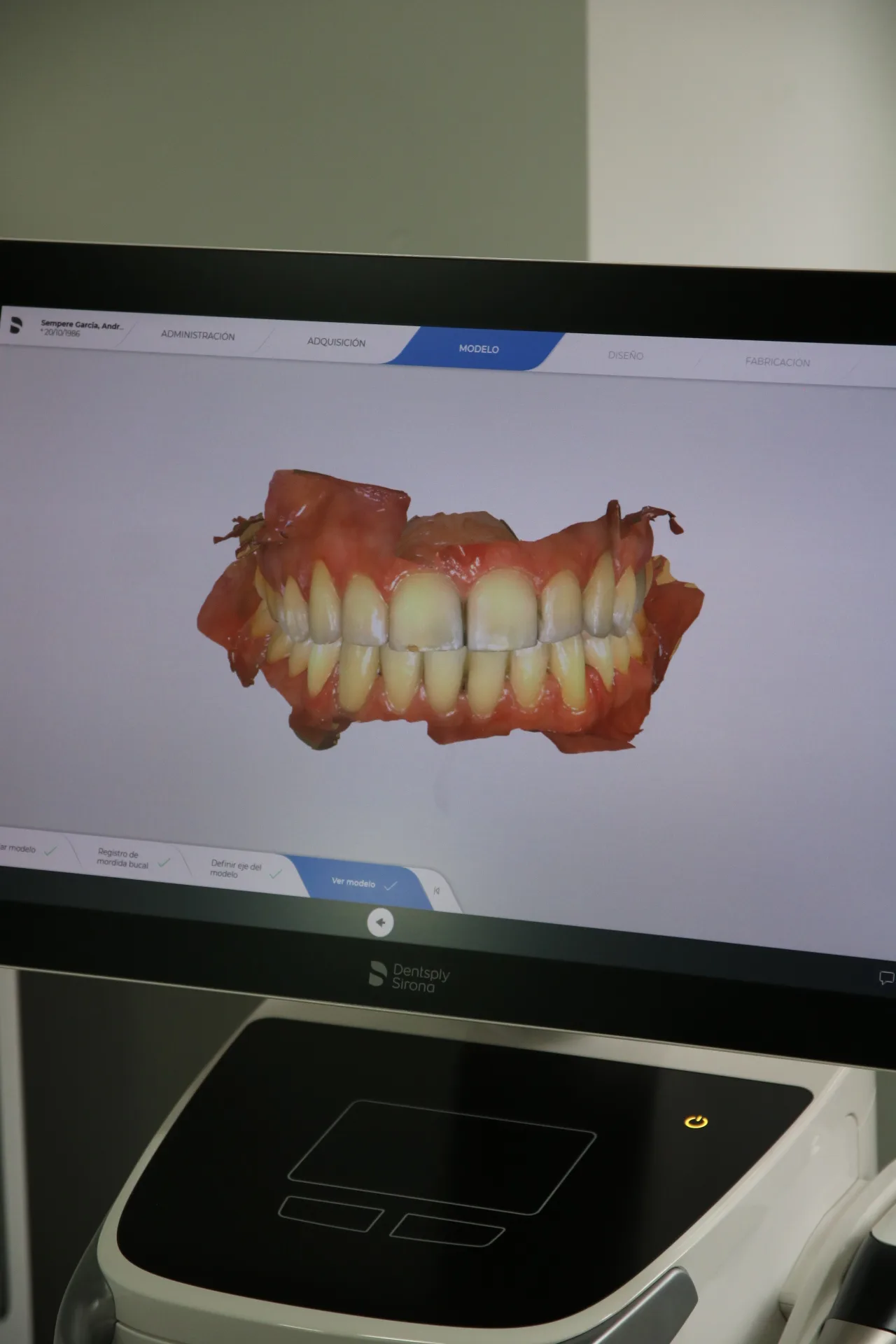 Ortodoncia en Alicante