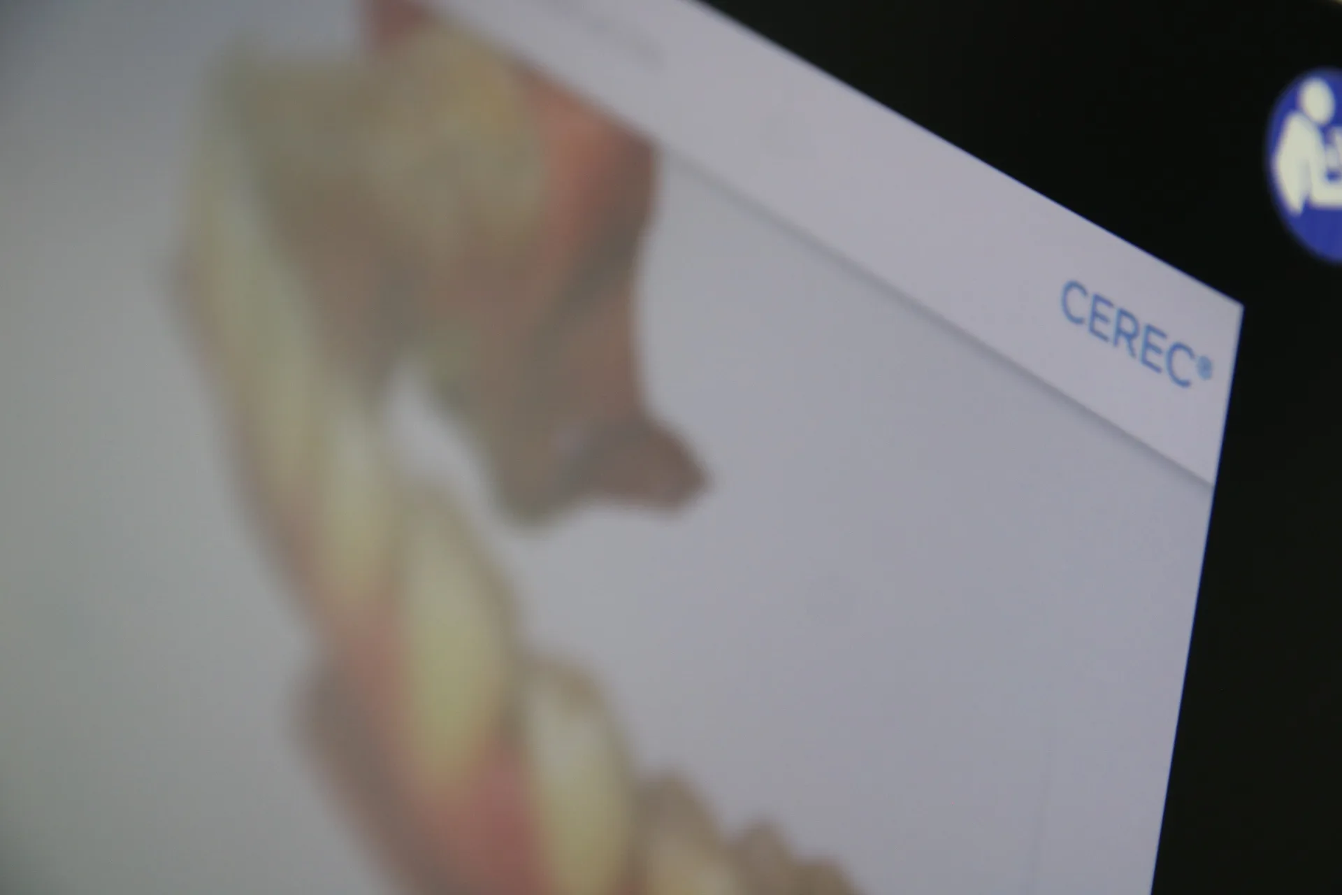 Escáner intraoral 3D para planificación ortodóncica en PerioMax Alicante