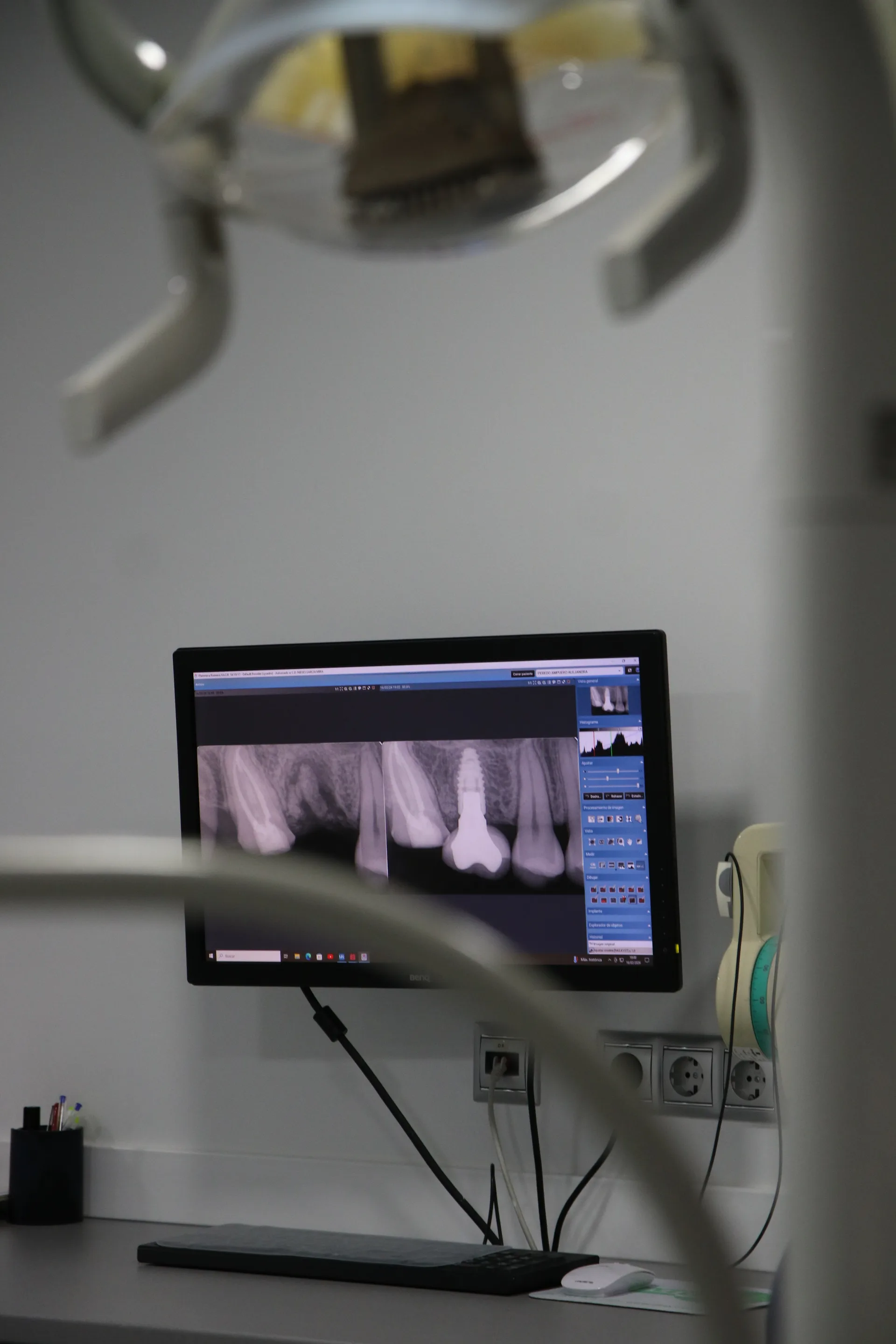 Gabinete dental equipado para tratamiento periodontal en PerioMax Alicante