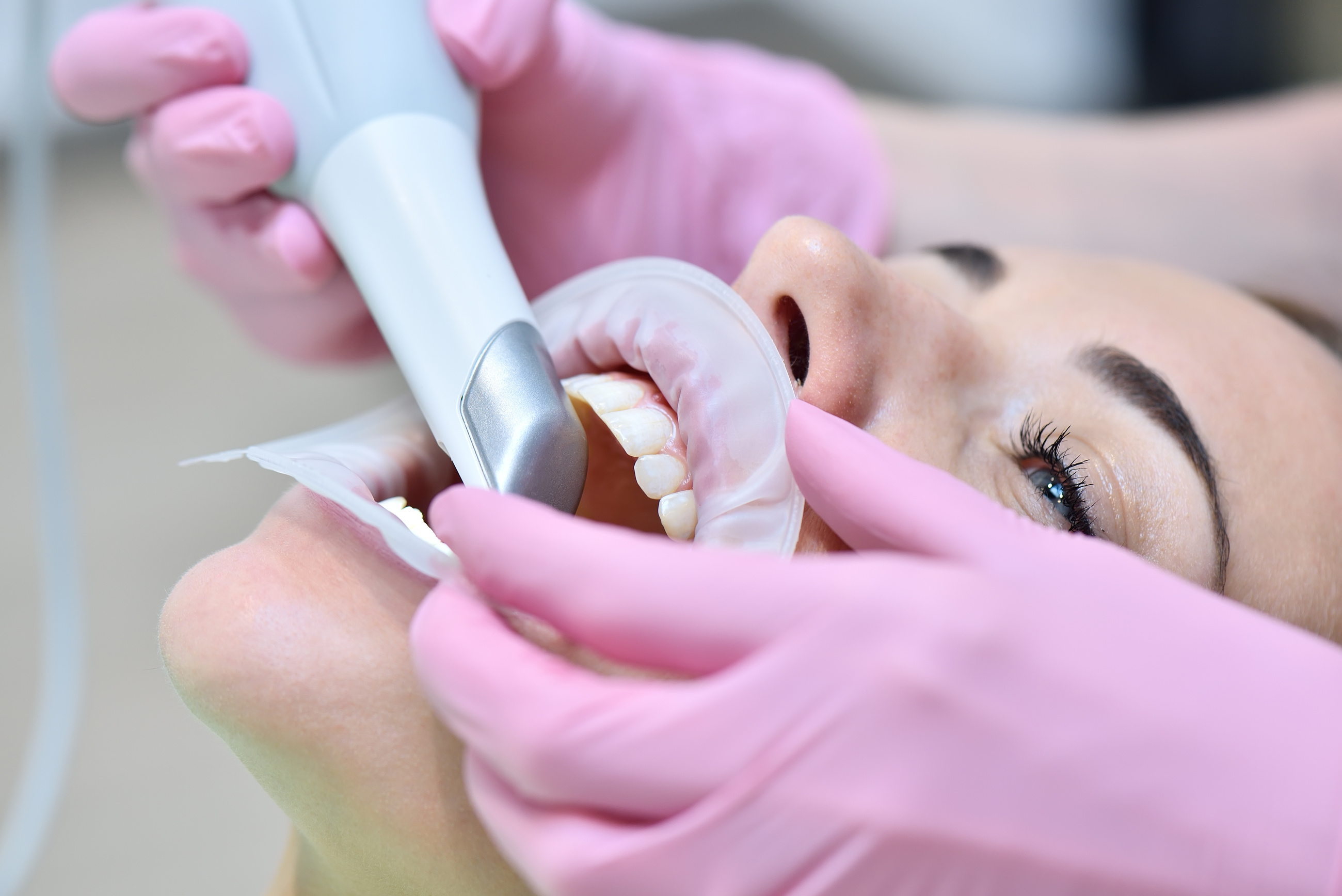 Orthodontist Scaning Patient with Dental Intraoral Scanner.